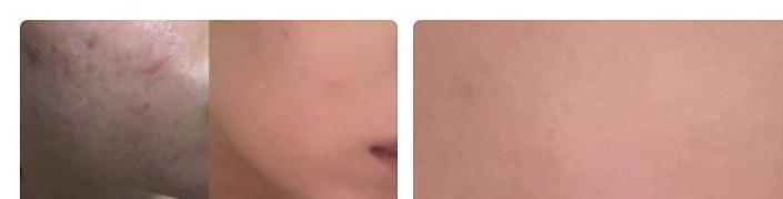 Customer review photo
