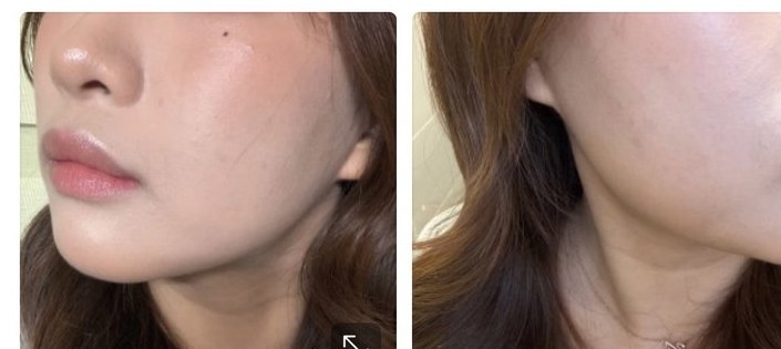Customer review photo